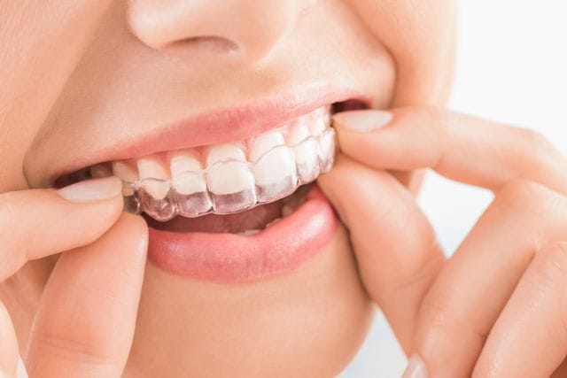 tratamiento dental invisalign