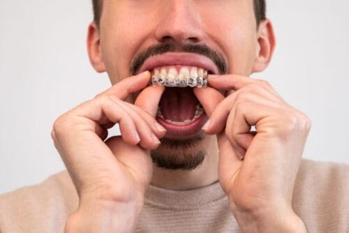 molestias invisalign aparatos invisibles